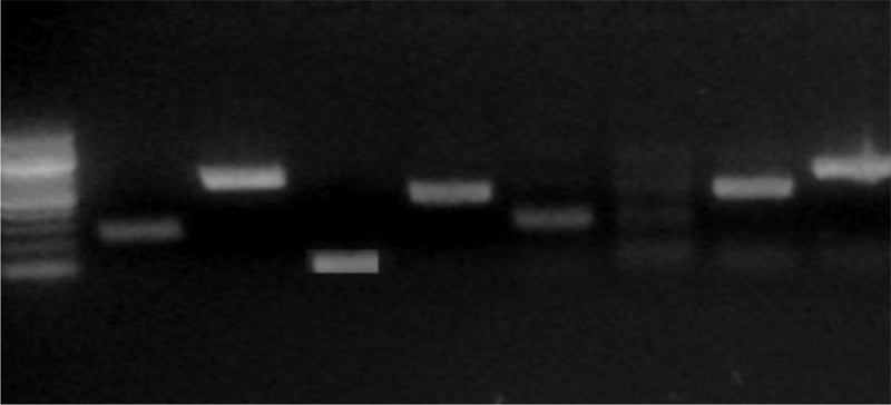 Figura 1. Protocolo de PCR multiplex para la detección de alfavirus con potencial epidémico. El canal 1 contiene el marcador de PM. Usando los cebadores específicos por separado, se obtuvo amplificación de las cepas correspondientes. Las longitudes de los segmentos fueron: 247 pb para Mayaro (canal2), 585 pb de EEE (Canal 3), 87 Pb de CHIKV (Canal 4) y 426 pb de TC-83 (Canal 5). 6) Mezcla de cebadores de Mayaro y EEE con muestra de Mayaro: 7) Cebadores de MAY y CHIKV con muestra de CHIKV, 8) Y 9) Mezcla de todos los cebadores con muestra de TC-83 y EEE, respectivamente.
