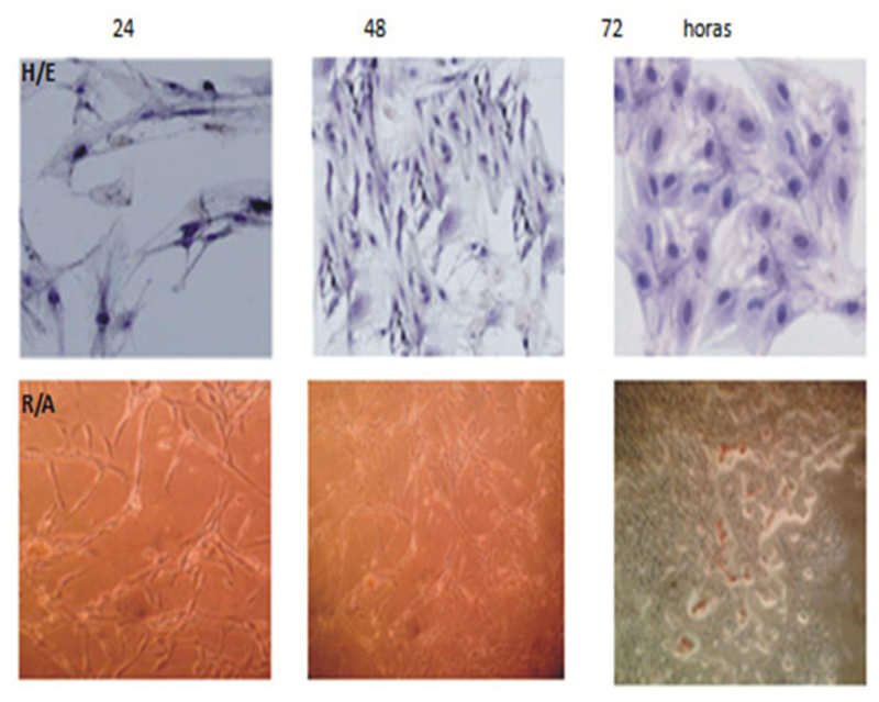 Figura 1. Osteoblastos en distintos tiempos de cultivo a 24, 48 y 72 hrs. Coloración de H/E y coloración de rojo de alizarina. Microscopio Olympus X71 de Fluorescencia Para H/E yRA (60X).