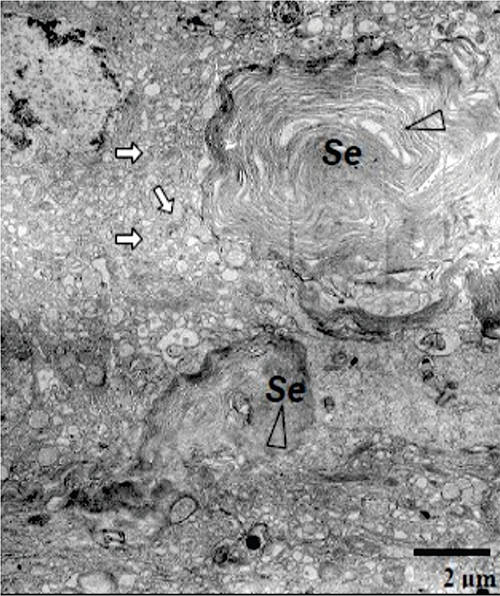 Figura 4. Micrografía electrónica del fotorreceptor del órgano pineal de Oxydoras sifontesi en la fase diurna. El segmento interno (Se) está internalizado (tomado de Chávez-Aponte et al. 2009).