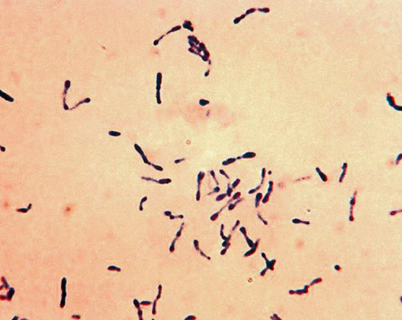Bacilo de Corynebacterium diphtheriae. Foto del CDC.