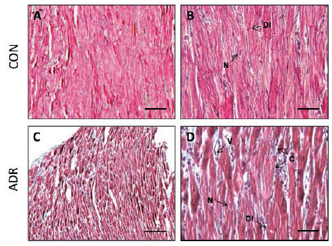 Figura 2 Micrografías ópticas de la pared ventricular izquierda del corazón de ratas Sprague Dawley a las seis semanas post-tratamiento con adriamicina (6 mg/kg p.c.) CON: A y B, ADR: C y D. N: Núcleo; DI: Disco intercalar; V: Vaso; C: Tejido conectivo. Micrografías A y C: Barra 250 μm, 10x. Micrografías B y D: Barra 70 μm, 40X. CON: Control; ADR: adriamicina.