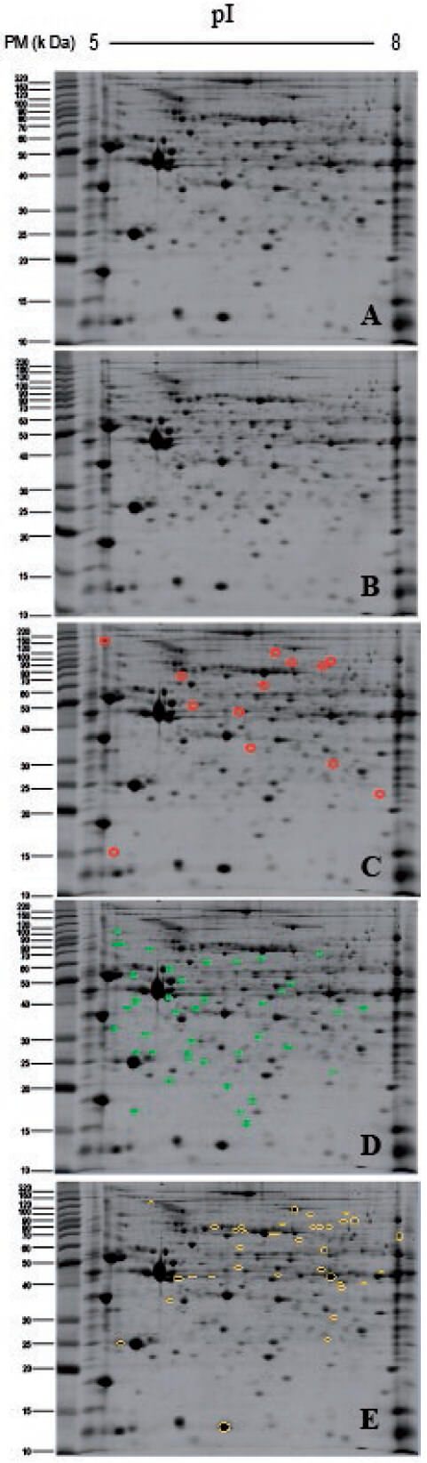 Figura 3 Perfiles proteícos de la pared ventricular izquierda de corazón de rata SpragueDawley del grupo ADR respecto al grupo CON, a las seis semanas post-tratamiento. A: Perfil proteíco del grupo CON. B: Perfil proteíco del grupo ADR. C: Perfil proteíco del grupo CON, señalando en círculo, los puntos proteicos ausentes en el perfil proteíco del grupo ADR, a las seis semanas post-tratamiento. D: Perfil proteíco del grupo CON, señalando en círculo, los puntos proteicos, que presentaron un incremento en su abundancia relativa (DO > 1,5), estadísticamente significativa (±1,5 veces; p ˂ 0,05 t-Students), en el perfil proteíco del grupo ADR respecto al del grupo CON. E: Perfil proteíco del grupo CON, señalando en círculo, los puntos proteicos, que presentaron una reducción en su abundancia relativa (DO ˂ 1,5), estadísticamente significativa (±1,5 veces; p ˂ 0,05 t-Students), en el perfil proteíco del grupo ADR respecto al del grupo CON. Todas las muestras fueron procesadas por duplicado bajo las mismas condiciones: 150 μg de proteínas, tiras de pH (IPG) de 5-8 para el isoelectroenfoque y geles de poliacrilamida de 12,5 % en la segunda dimensión. CON: control, ADR: adriamicina (6mg/Kg p.c.).