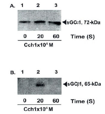 Figure 3. Western blotting analysis of α1β1 NO-sGC-subunits at plasma membranes from BASM under muscarinic activation (Alfonzo et al., 2013). Identification of α1/β1 sGC heterodimer at plasma membrane fractions isolated from BTSM strips under muscarinic agonist exposure. Isolated BASM strips were incubated in KRB at 37°C in the presence of muscarinic agonist CC (1 x10−5 M) during 0, 20 s and 60 s. The samples were immediately frozen and pulverized with a mortar in liquid nitrogen, following the protocols described to isolate plasma membranes fraction (González de Alfonzo et al., 1996). These membranes sediments were run in 12% PAGE-SDS, transferred to nitrocellulose membranes, and probed with specific antibodies against the α1, α2, (Panel A) β1 and β2 (Panel B) of NO-sGC subunits.