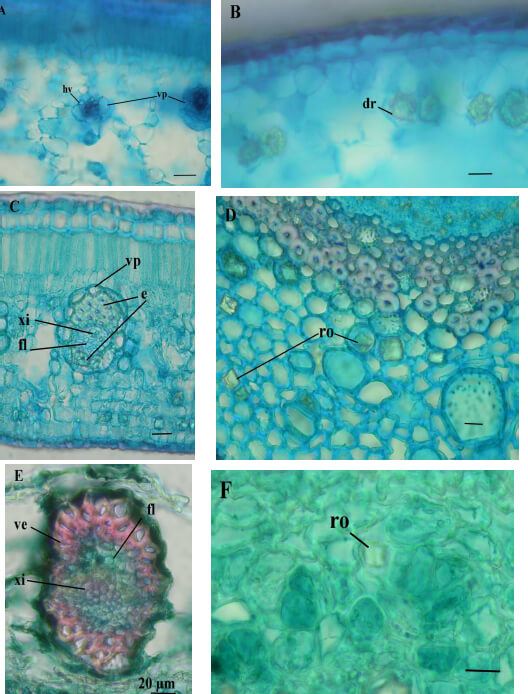 Figura 5. ·Detalles estructurales en sección transversal de la hoja en especies de Myrcianthes. A- y B- M. fragrans, C- y D- M. prodigiosa, E- y F- M. rhopaloides. Escala = 20 m en todos los casos. dr = drusa, e = esclerénquima, fl = floema, hv = haz vascular, ro = cristal romboide, ve = vaina de esclerénquima, vp= viana de parénquima, xi = xilema.