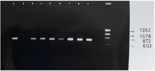Figura 3. Productos de PCR de muestras provenientes de pacientes en electroforesis en gel de agarosa al 1% usando primers B1 y B2. 1: Control positivo / 2: Control negativo / 3-9: Pacientes (P1-P7, respectivamente) / MPM: Marcador de peso molecular.
